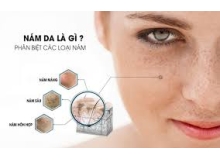 Phác Đồ Điều Trị Nám - Tàn Nhang